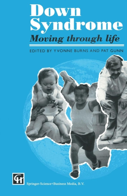 Book cover of: Down Syndrome