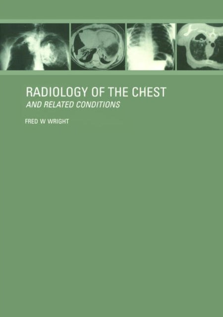 Book cover of: Radiology of the Chest and Related Conditions. By: F W Wright