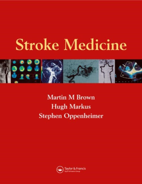 Book cover of: Stroke Medicine. By: Martin M. Brown