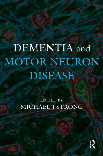 Book cover of: Dementia and Motor Neuron Disease. By: Michael J. Strong