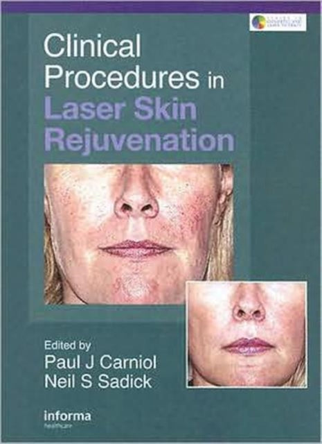 Book cover of: Clinical Procedures in Laser Skin Rejuvenation