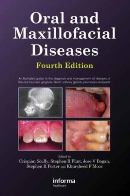 Book cover of: Oral and Maxillofacial Diseases, Fourth Edition