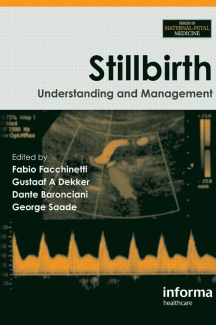 Book cover of: Stillbirth. By: Fabio Facchinetti