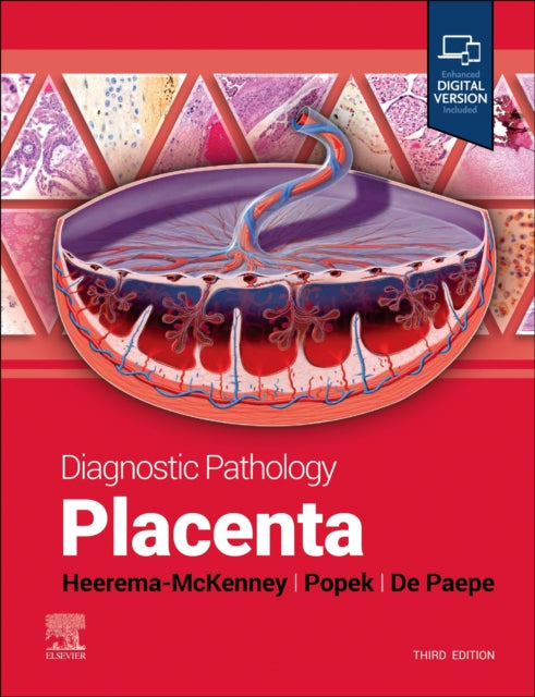 Book cover of: Diagnostic Pathology: Placenta. By: Amy Heerema-McKenney