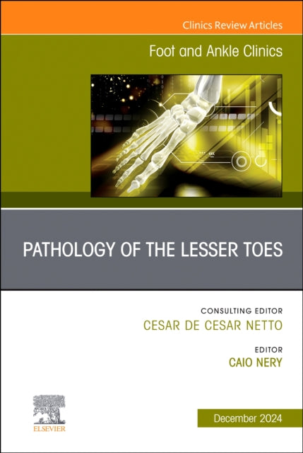 Book cover of: Pathology of the Lesser Toes, An issue of Foot and Ankle Clinics of North America