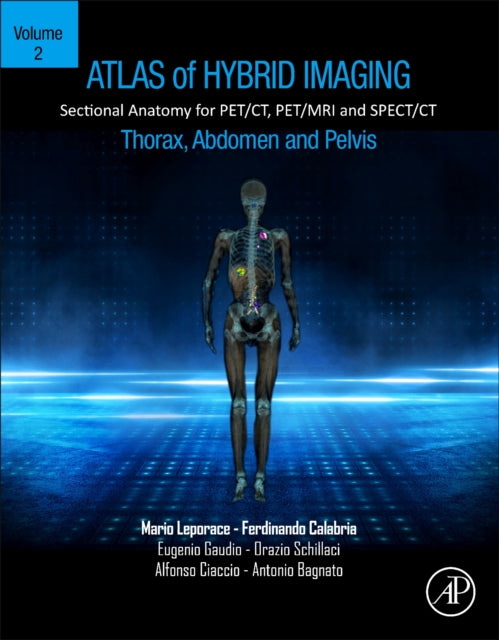 Book cover of: Atlas of Hybrid Imaging Sectional Anatomy for PET/CT, PET/MRI and SPECT/CT Vol. 2: Thorax Abdomen and Pelvis. By: Mario Leporace