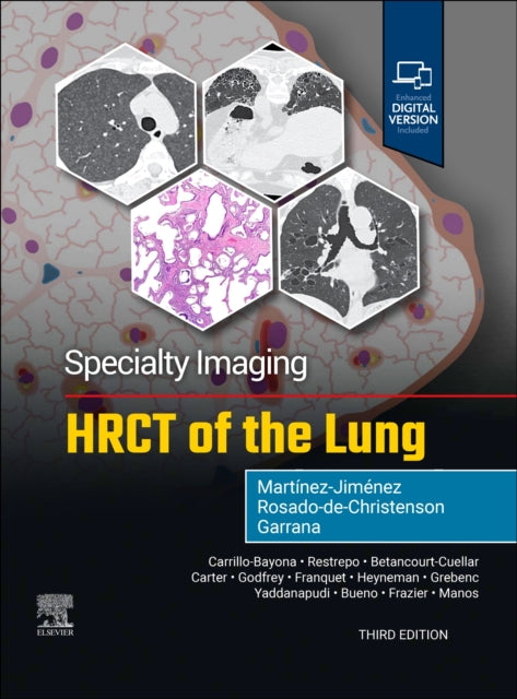 Book cover of: Specialty Imaging: HRCT of the Lung. By: Santiago Martínez-Jiménez