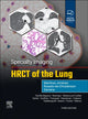Book cover of: Specialty Imaging: HRCT of the Lung. By: Santiago Martínez-Jiménez