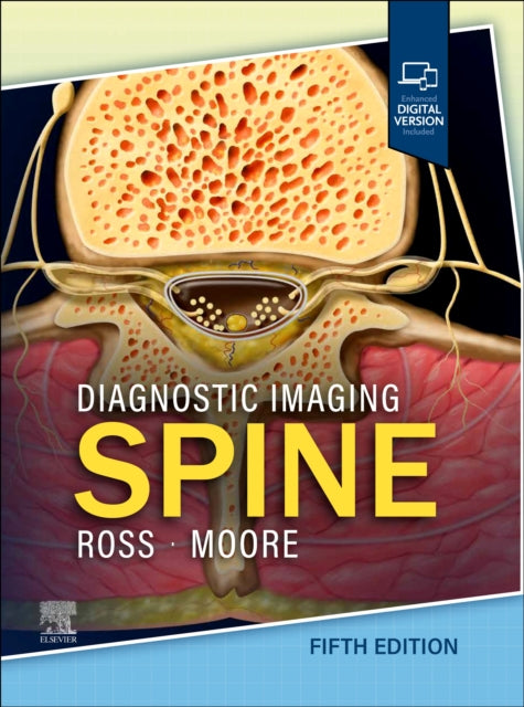 Book cover of: Diagnostic Imaging: Spine