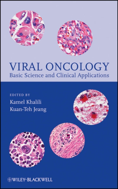 Book cover of: Viral Oncology