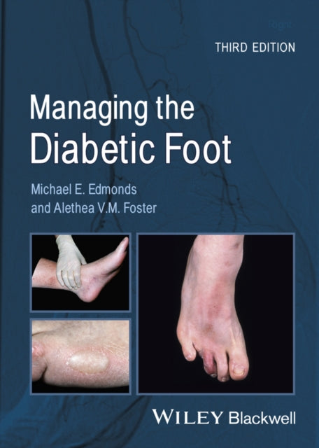 Book cover of: Managing the Diabetic Foot. By: Michael E. Edmonds