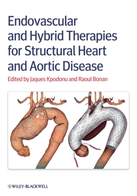 Book cover of: Endovascular and Hybrid Therapies for Structural Heart and Aortic Disease