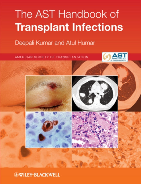 Book cover of: AST Handbook of Transplant Infections