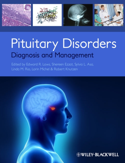 Book cover of: Pituitary Disorders. By: Edward R. Laws