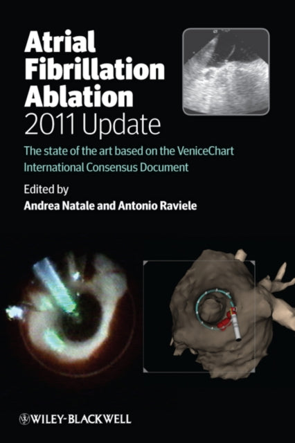 Book cover of: Atrial Fibrillation Ablation, 2011 Update