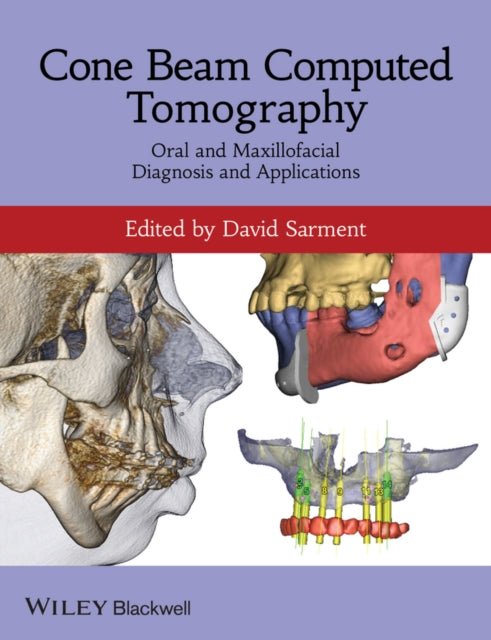 Book cover of: Cone Beam Computed Tomography. By: David Sarment