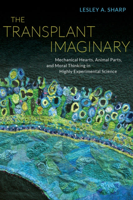 Book cover of: Transplant Imaginary