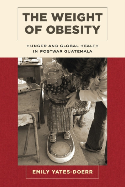 Book cover of: Weight of Obesity. By: Emily Yates-Doerr