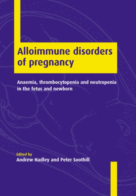 Book cover of: Alloimmune Disorders of Pregnancy