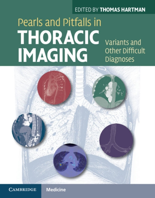 Book cover of: Pearls and Pitfalls in Thoracic Imaging. By: Thomas Hartman