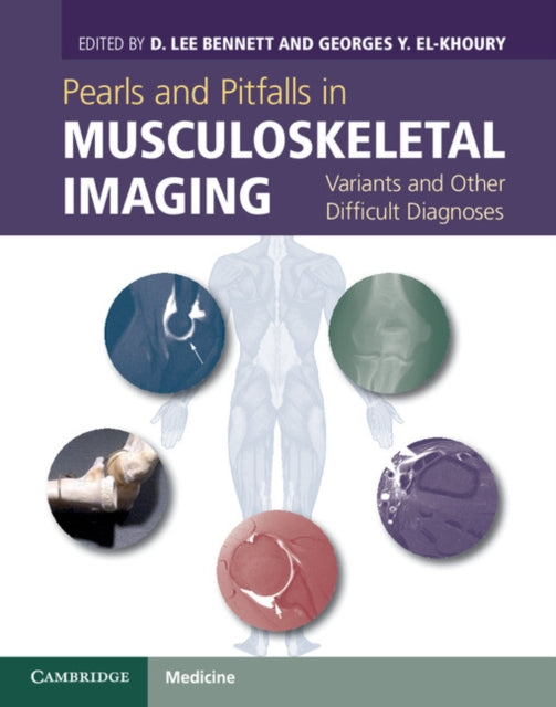 Book cover of: Pearls and Pitfalls in Musculoskeletal Imaging. By: D. Lee Bennett