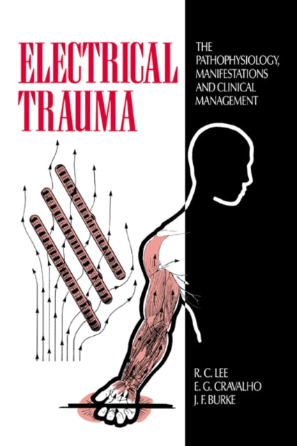 Book cover of: Electrical Trauma