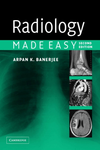 Book cover of: Radiology Made Easy. By: Arpan K. Banerjee