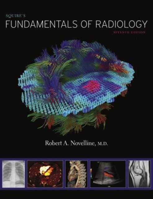 Book cover of: Squire’s Fundamentals of Radiology. By: Robert A. Novelline M.D.