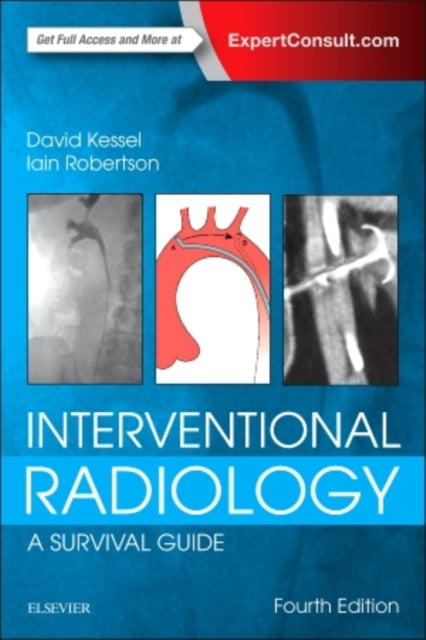 Book cover of: Interventional Radiology: A Survival Guide. By: David Kessel