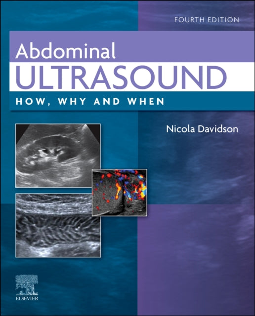 Book cover of: Abdominal Ultrasound. By: Nicola Davidson