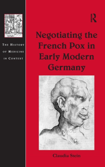 Book cover of: Negotiating the French Pox in Early Modern Germany. By: Claudia Stein