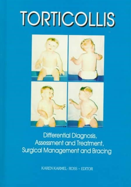 Book cover of: Torticollis. By: Karen Karmel-Ross