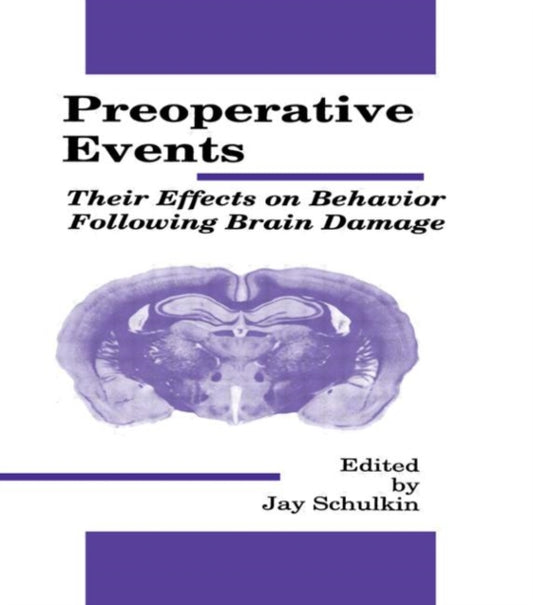 Book cover of: Preoperative Events. By: Jay Schulkin