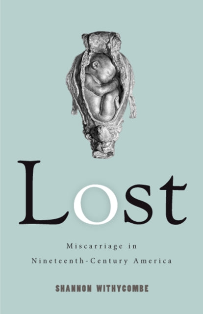 Book cover of: Lost. By: Shannon Withycombe