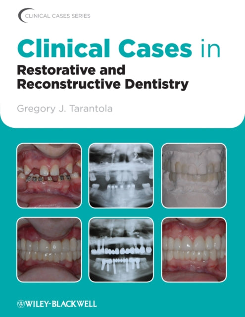 Book cover of: Clinical Cases in Restorative and Reconstructive Dentistry. By: Gregory J. Tarantola