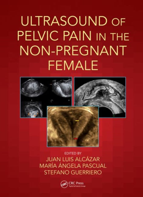 Book cover of: Ultrasound of Pelvic Pain in the Non-Pregnant Patient. By: Juan Luis Alcázar