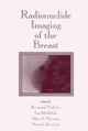 Book cover of: Radionuclide Imaging of the Breast