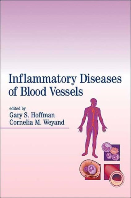 Book cover of: Inflammatory Diseases of Blood Vessels. By: Hoffman/Weyand