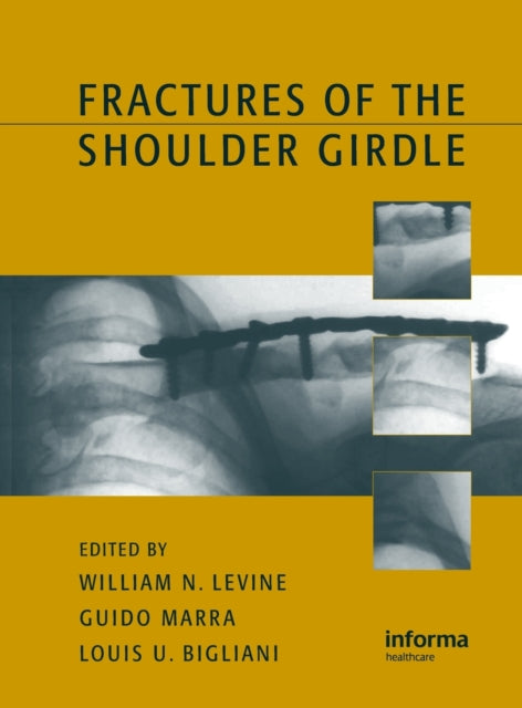 Book cover of: Fractures of the Shoulder Girdle. By: William N. Levine