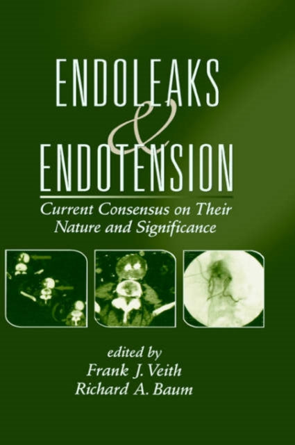 Book cover of: Endoleaks and Endotension