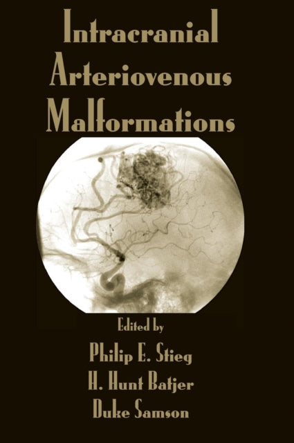 Book cover of: Intracranial Arteriovenous Malformations