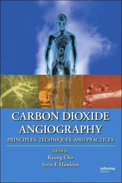 Book cover of: Carbon Dioxide Angiography