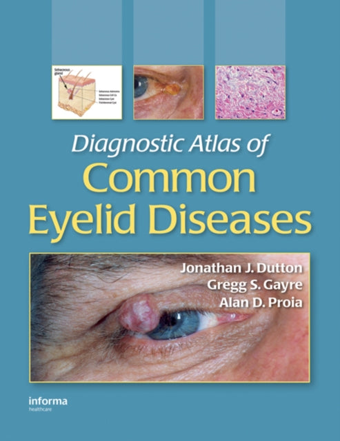 Book cover of: Diagnostic Atlas of Common Eyelid Diseases. By: Jonathan J. Dutton