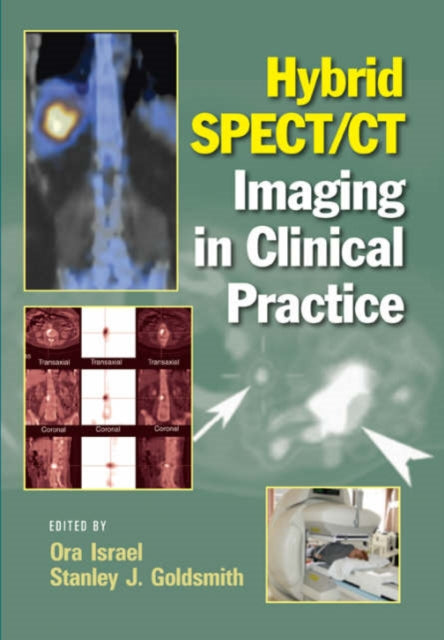 Book cover of: Hybrid SPECT/CT Imaging in Clinical Practice