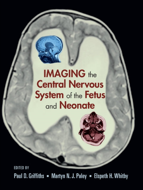 Book cover of: Imaging the Central Nervous System of the Fetus and Neonate