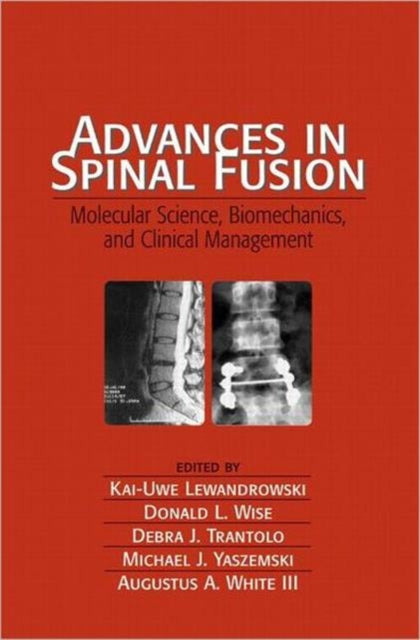 Book cover of: Advances in Spinal Fusion. By: Kai-Uwe Lewandrowski