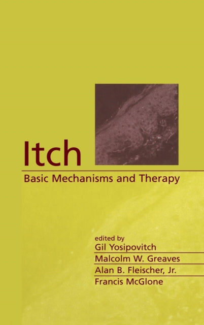 Book cover of: Itch