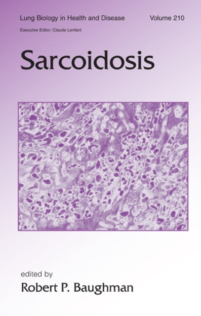 Book cover of: Sarcoidosis