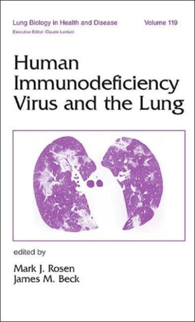 Book cover of: Human Immunodeficiency Virus and the Lung