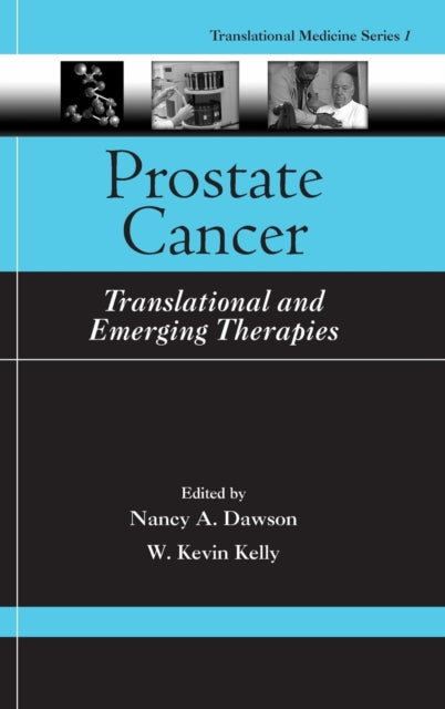 Book cover of: Prostate Cancer